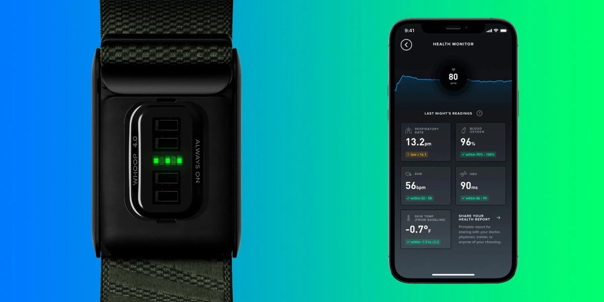 Is Whoops Monthly Subscription Cost Worth the Price?